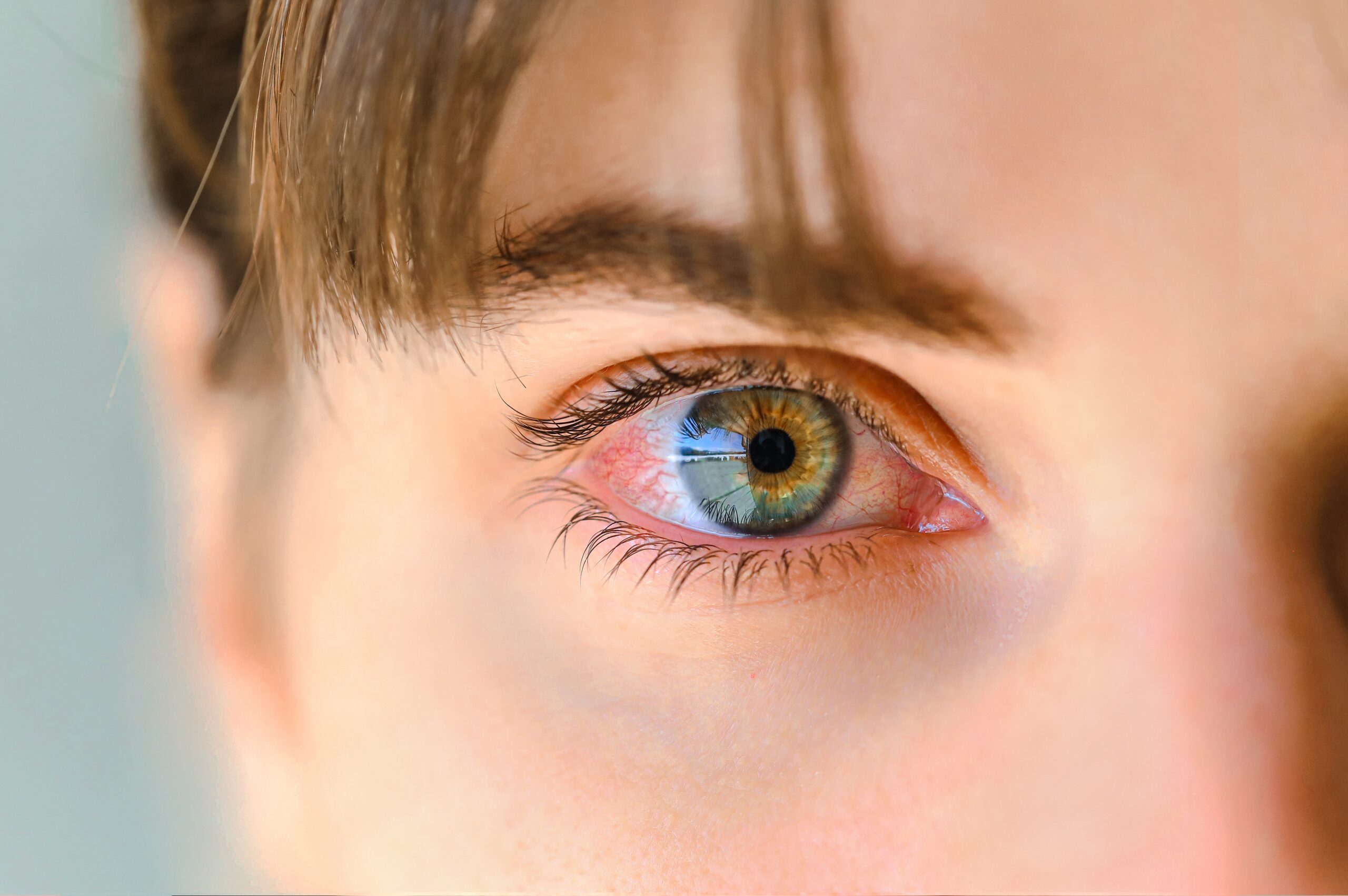 dry eye treatment and symptoms